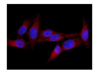 MID1 Rabbit Polyclonal Antibody