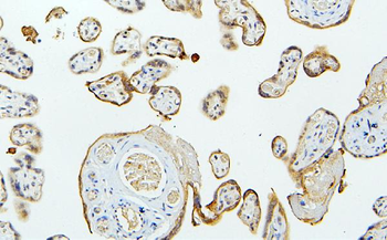MID1 Rabbit Polyclonal Antibody