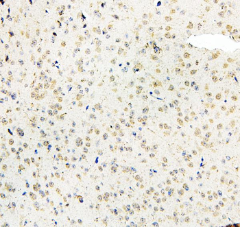 MID1 Rabbit Polyclonal Antibody