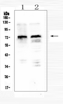 MID1 Rabbit Polyclonal Antibody