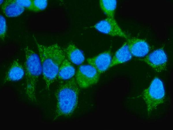 ARAF Rabbit Polyclonal Antibody