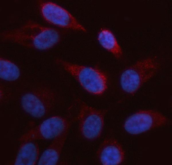 ARAF Rabbit Polyclonal Antibody