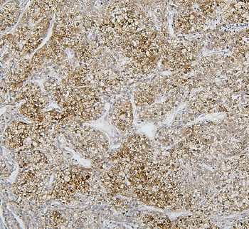 Cytochrome p450 2C19/CYP2C19 Rabbit Polyclonal Antibody
