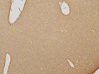 Cytochrome p450 2C19/CYP2C19 Rabbit Polyclonal Antibody