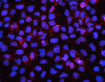 EHD1 Antibody