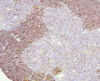 CD8 alpha/Cd8a Rabbit Polyclonal Antibody