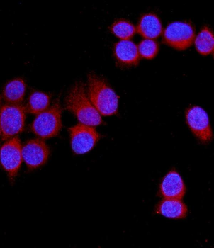 NRAMP1/SLC11A1 Rabbit Polyclonal Antibody