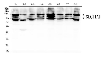 NRAMP1/SLC11A1 Rabbit Polyclonal Antibody