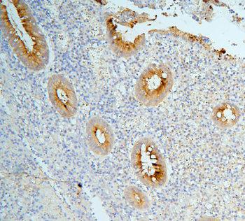 MUC13 Rabbit Polyclonal Antibody