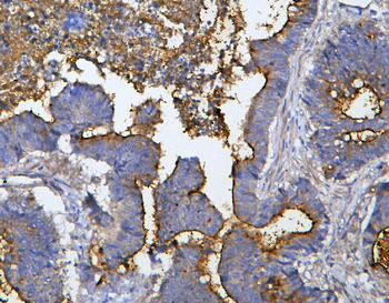 MUC13 Rabbit Polyclonal Antibody
