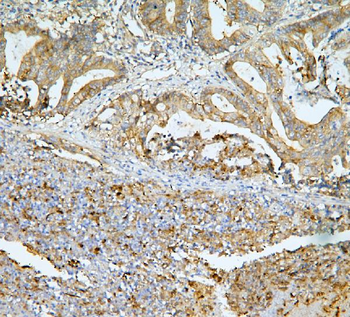 MUC13 Rabbit Polyclonal Antibody