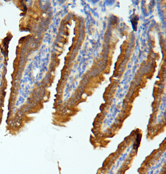 MUC13 Rabbit Polyclonal Antibody
