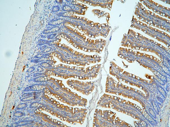 MUC13 Rabbit Polyclonal Antibody
