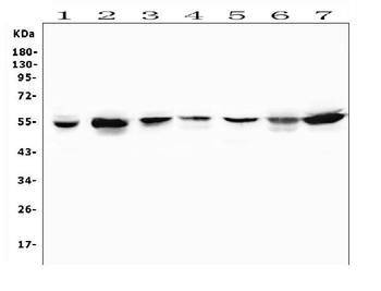 MUC13 Rabbit Polyclonal Antibody