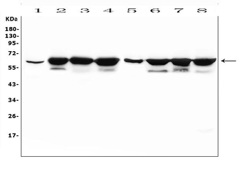 KAT9/ELP3 Rabbit Polyclonal Antibody