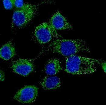 LONP1/Lon Rabbit Polyclonal Antibody