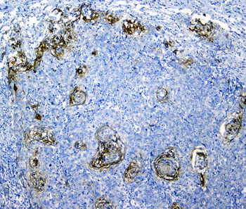 SLC34A2 Antibody