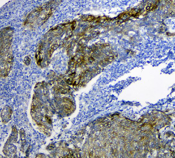 SLC34A2 Antibody