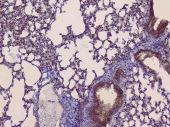 SLC34A2 Antibody