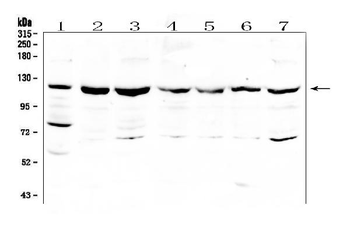 RNF31/HOIP Rabbit Polyclonal Antibody