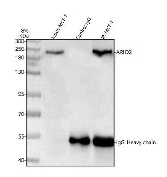 ARID2 Rabbit Polyclonal Antibody
