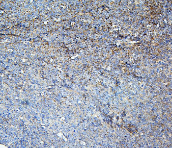 Loricrin/LOR Rabbit Polyclonal Antibody