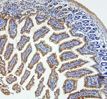 Loricrin/LOR Rabbit Polyclonal Antibody