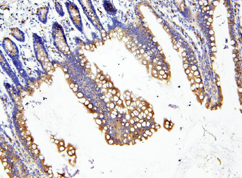 Loricrin/LOR Rabbit Polyclonal Antibody
