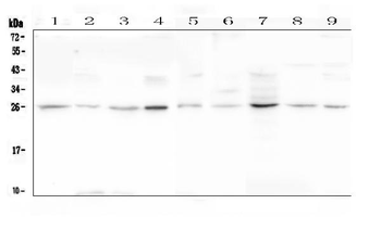 Loricrin/LOR Rabbit Polyclonal Antibody