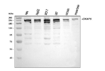 ch TOG/CKAP5 Rabbit Polyclonal Antibody