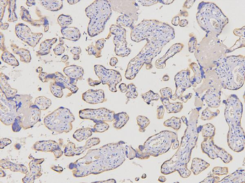 D6/ACKR2 Rabbit Polyclonal Antibody