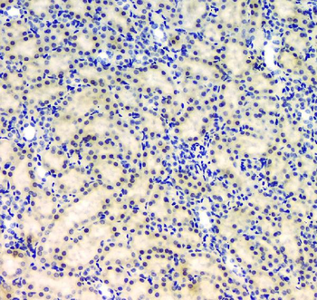 BCL9L Antibody