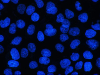BCL9L Antibody