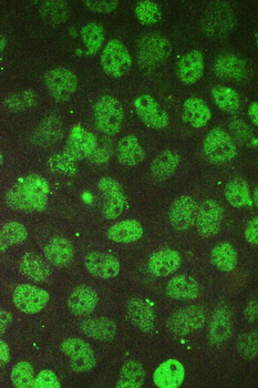 BCL9L Antibody