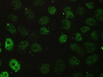 BCL9L Antibody