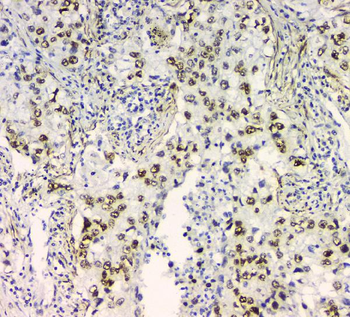BCL9L Antibody