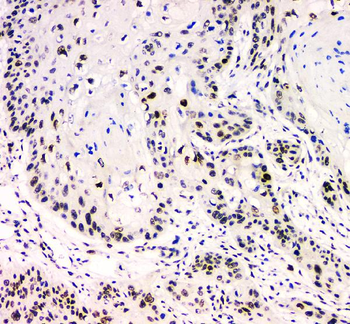BCL9L Antibody
