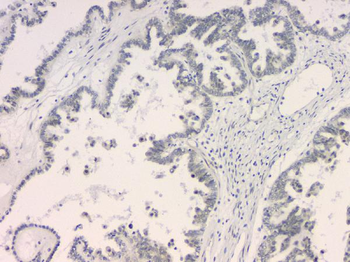 BCL9L Antibody