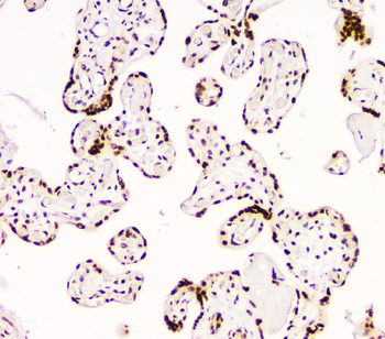 BCL9L Antibody