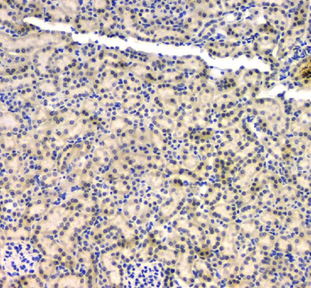 BCL9L Antibody