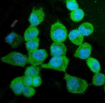 KIF15 Rabbit Polyclonal Antibody