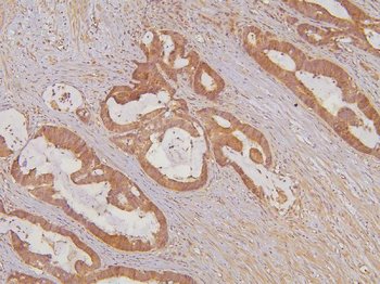KIF15 Rabbit Polyclonal Antibody