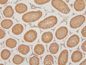 KIF15 Rabbit Polyclonal Antibody