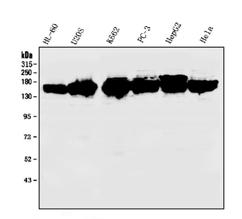 KIF15 Rabbit Polyclonal Antibody