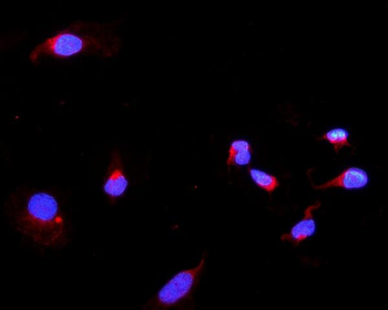 DARS2 Rabbit Polyclonal Antibody