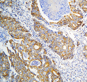 DARS2 Rabbit Polyclonal Antibody