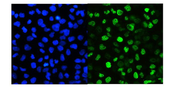 SMARCAD1 Antibody