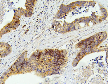 SMARCAD1 Antibody