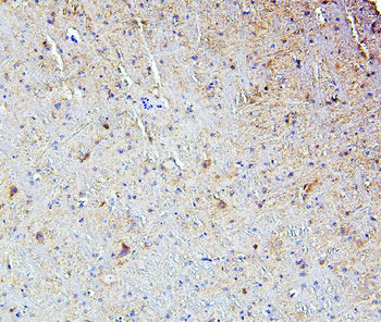SMARCAD1 Antibody