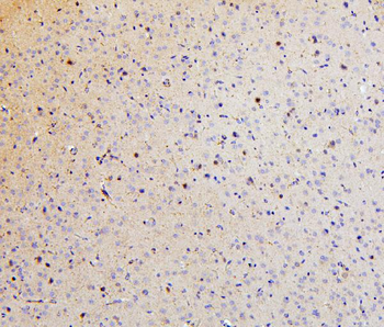 SMARCAD1 Antibody
